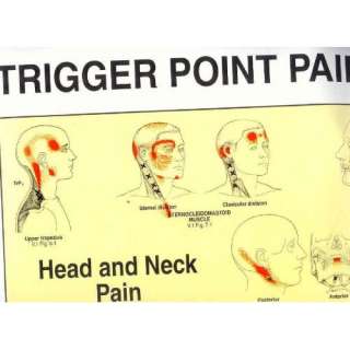  Trigger Points of Pain Wall Charts (Set of 2 