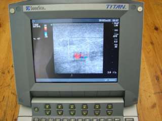 SonoSite TITAN Portable ultrasound & Two Probe Sonde  