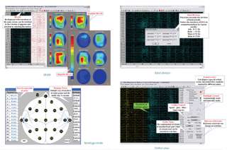 Digital EEG And Mapping System Digital 16 channel EEG  