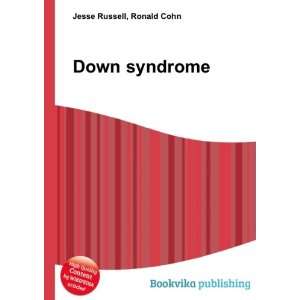  Down syndrome Ronald Cohn Jesse Russell Books