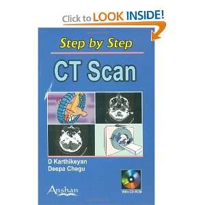  Step by Step Ct Scan (Step by Step (Anshan)) [Paperback 